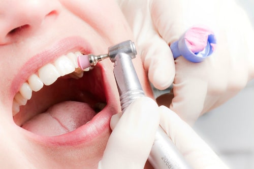 Подготовка зубов к протезированию 